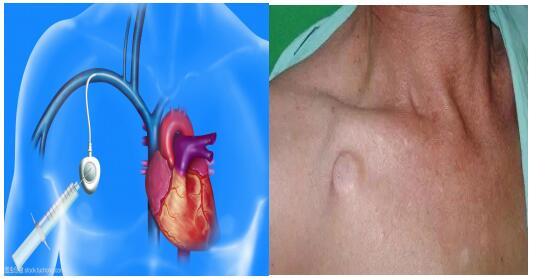 QQ截图20210605163932.jpg QQ截图20210605163932.jpg